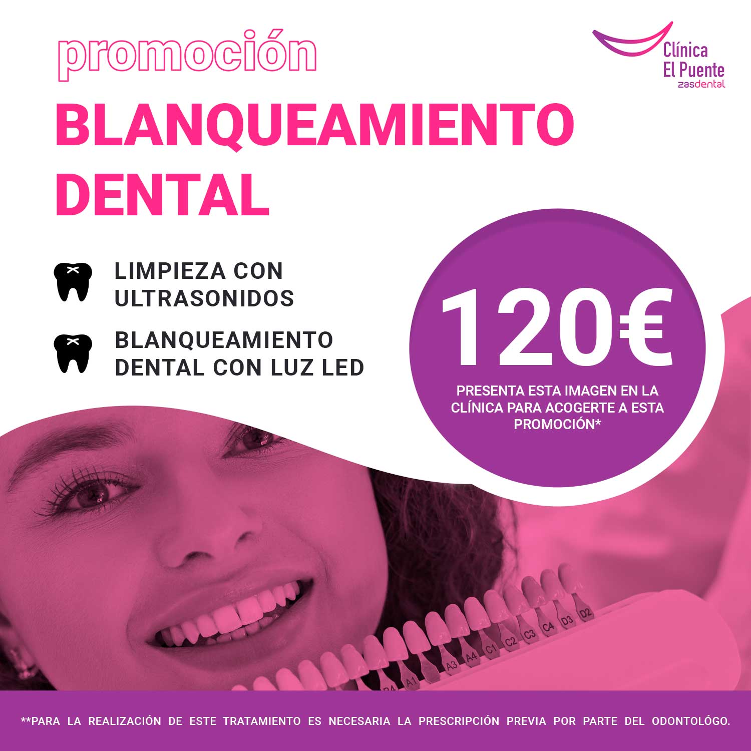 Promoción en blanqueamiento dental Clínica Dental El Puente - Zas Dental