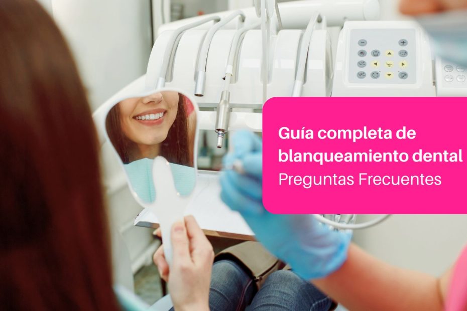 guía completa blanqueamiento dental