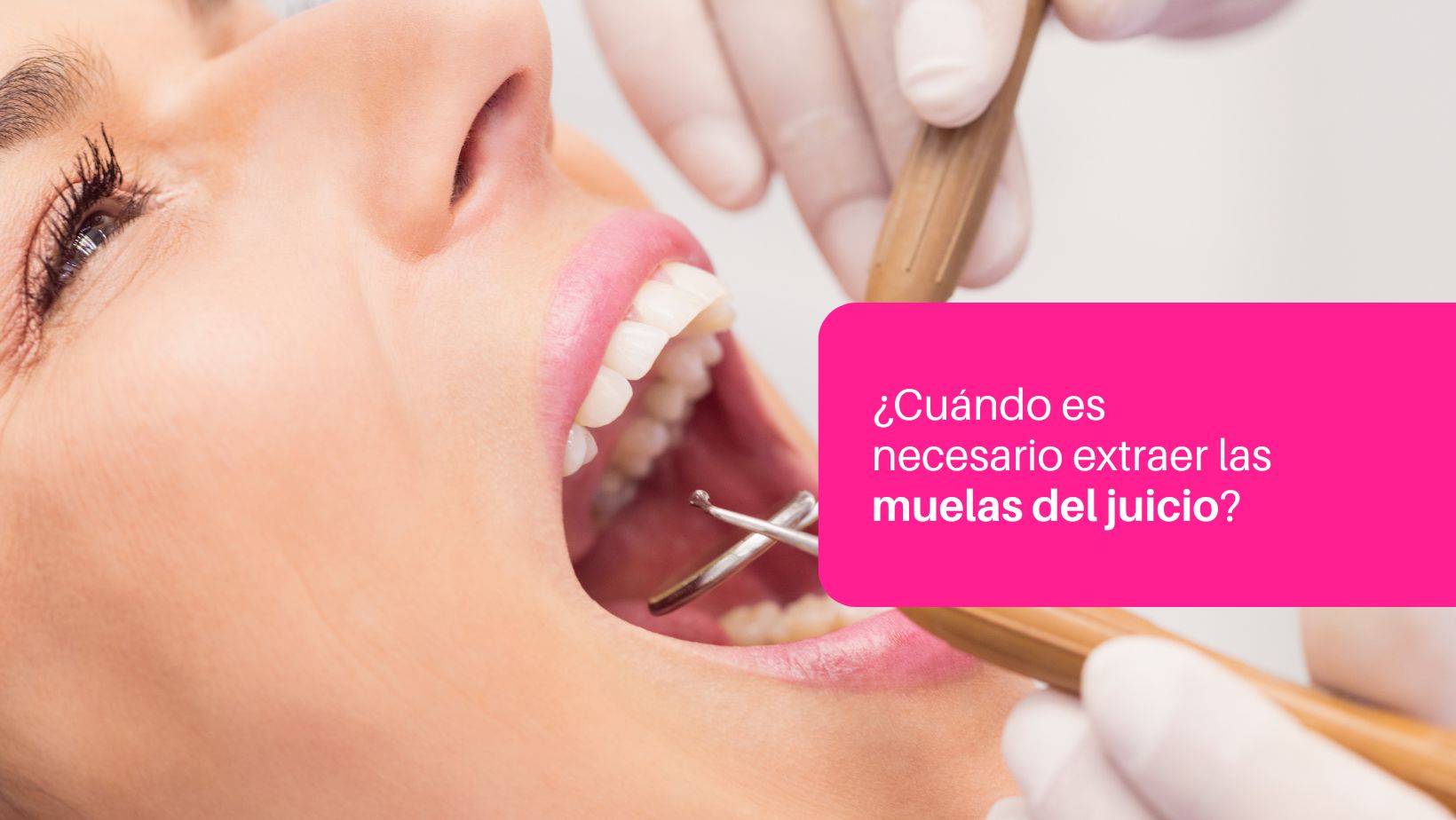 extraer muelas juicio